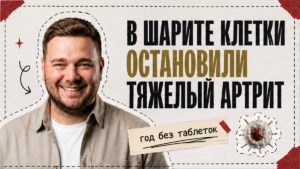 Клиника Charité испытала терапию CAR-T при тяжёлом артрите
