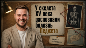 Скелет XV века на Лансароте сохранил следы костной болезни Педжета