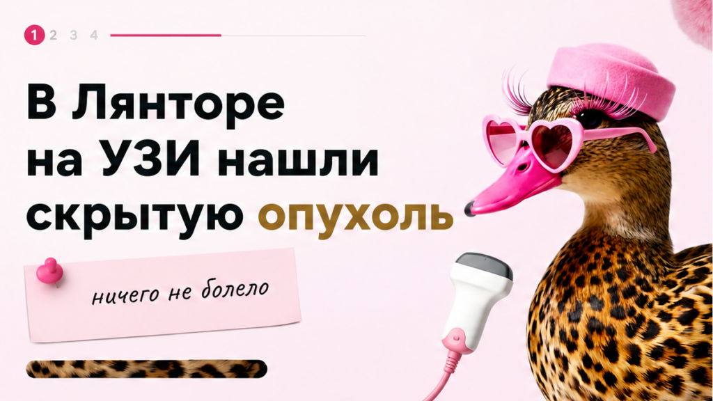 Иллюстрация: на плановом УЗИ в Лянторе нашли скрытую опухоль надпочечника