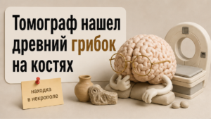 КТ костей из некрополя Сельвиччолы выявила следы системного микоза
